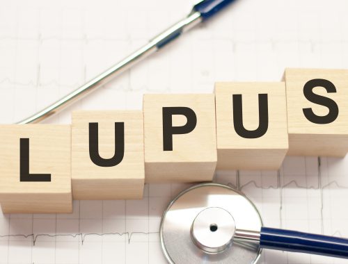Qué es el lupus