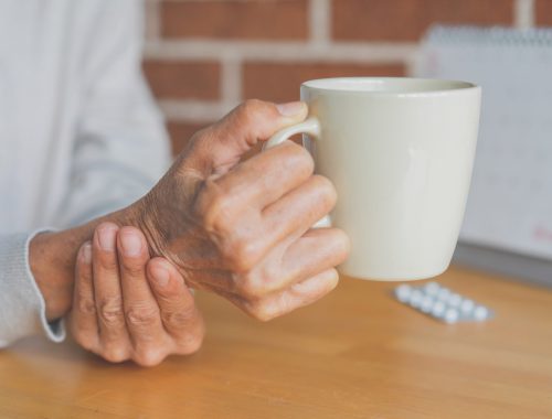 parkinson-neurodegeneracion-tratamiento_BLOGHLA