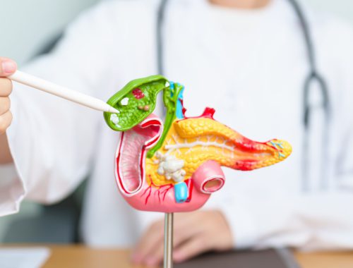 colangiocarcinoma-cancer-biliar