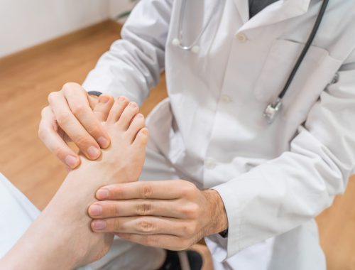 gota-sintomas-alimentacion